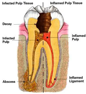 Anatomy of a Human Tooth