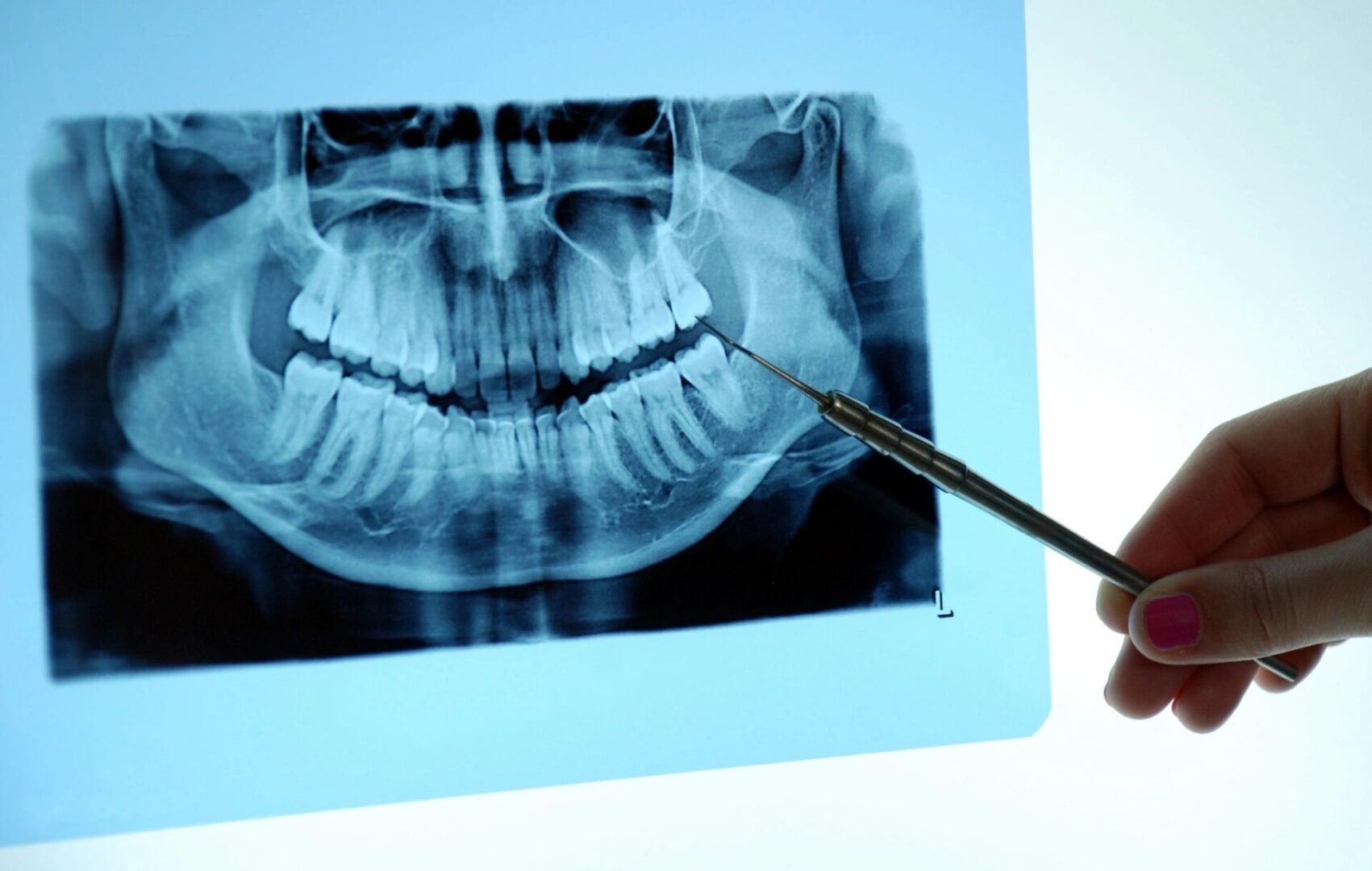 Doctor Examining Teeth X-Ray Image